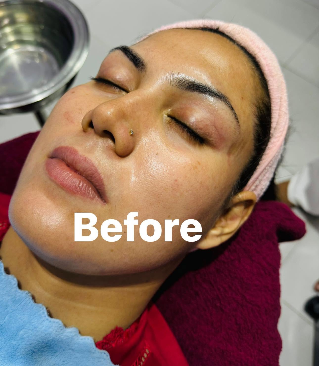 Skin transformation before
