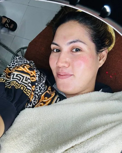 Mykonos Treatment result